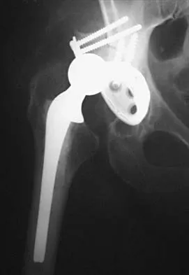 Hip 2001 Practice Questions: Set 1 (Solved) - Figure 20