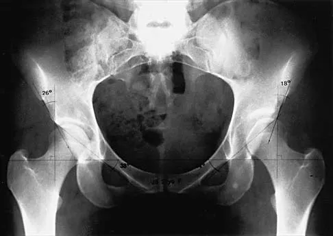 Hip 2001 Practice Questions: Set 1 (Solved) - Figure 4