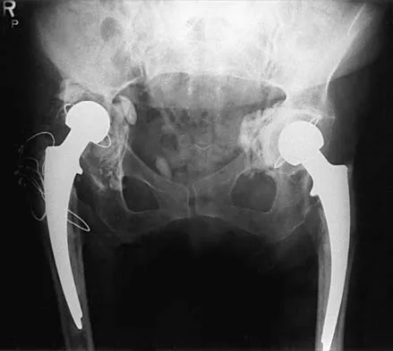 Hip Board Review 2001: High-Yield MCQs (Set 2) - Figure 11