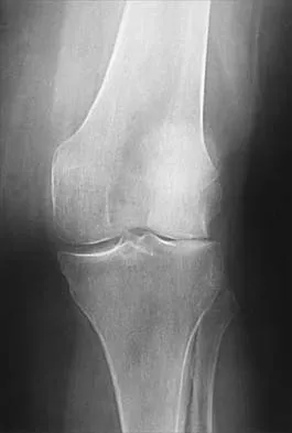 Hip Board Review 2001: High-Yield MCQs (Set 4) - Figure 3