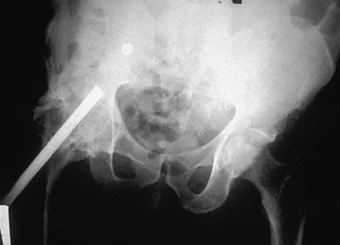 Hip 2004 Practice Questions: Set 1 (Solved) - Figure 10