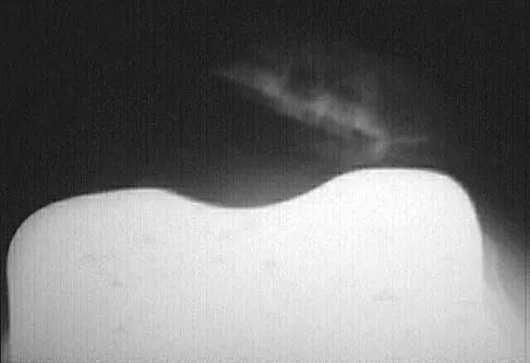 Hip 2004 Practice Questions: Set 1 (Solved) - Figure 19