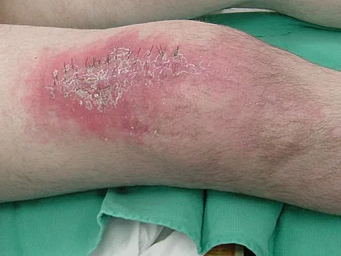 Hip 2004 Practice Questions: Set 1 (Solved) - Figure 21