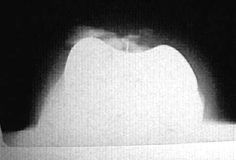 Hip 2004 Practice Questions: Set 1 (Solved) - Figure 24