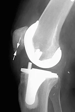 Hip 2004 Practice Questions: Set 1 (Solved) - Figure 29