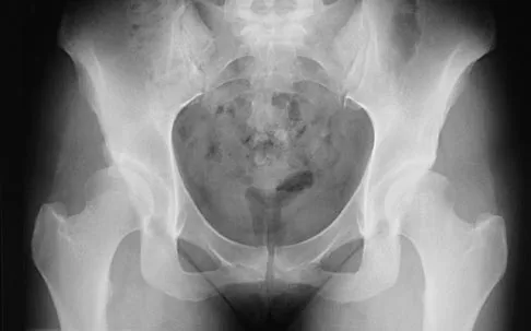 Hip 2004 Practice Questions: Set 1 (Solved) - Figure 3