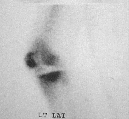 Hip Board Review 2004: High-Yield MCQs (Set 2) - Figure 10