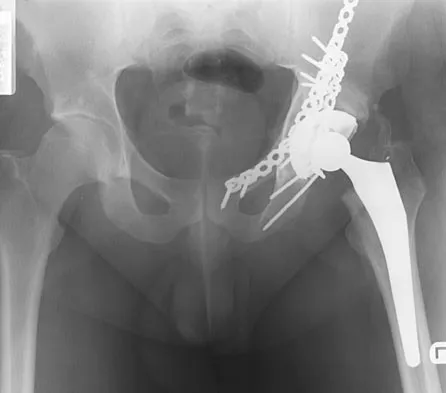 Hip 2004 Practice Questions: Set 3 (Solved) - Figure 6