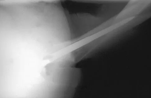 Hip 2004 Practice Questions: Set 3 (Solved) - Figure 8