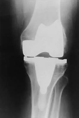 Hip 2026 MCQs: Board Review Questions & Answers (Part 1) - Figure 5