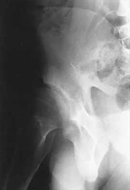 Hip 2026 MCQs: Board Review Questions & Answers (Part 1) - Figure 69