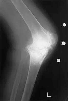 Hip 2026 MCQs: Board Review Questions & Answers (Part 2) - Figure 13