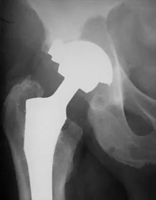 Hip 2026 MCQs: Board Review Questions & Answers (Part 2) - Figure 23