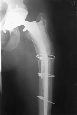 Hip 2026 MCQs: Board Review Questions & Answers (Part 2) - Figure 63