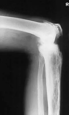 Hip 2026 MCQs: Board Review Questions & Answers (Part 2) - Figure 7