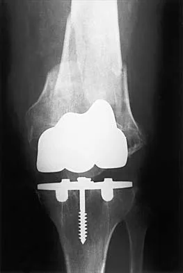 Hip 2026 MCQs: Board Review Questions & Answers (Part 3) - Figure 17