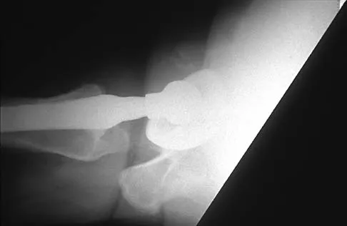 Hip 2026 MCQs: Board Review Questions & Answers (Part 4) - Figure 1