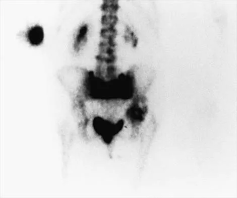 Hip 2026 MCQs: Board Review Questions & Answers (Part 4) - Figure 19