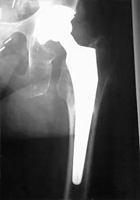 Hip 2026 MCQs: Board Review Questions & Answers (Part 4) - Figure 3