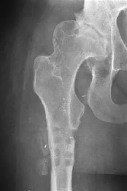 Hip 2026 MCQs: Board Review Questions & Answers (Part 4) - Figure 33