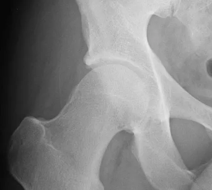 Hip & Knee Reconstruction 2007 Practice Questions: Set 1 (Solved) - Figure 31