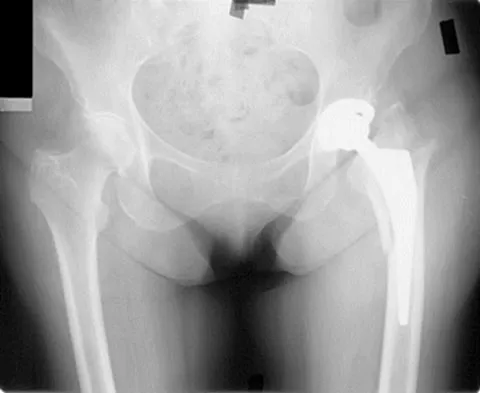 Hip & Knee Reconstruction Board Review 2007: High-Yield MCQs (Set 2) - Figure 16