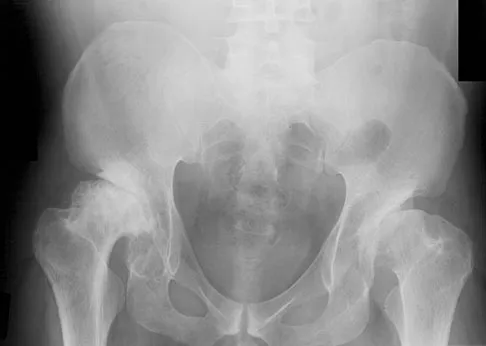 Hip & Knee Reconstruction Board Review 2007: High-Yield MCQs (Set 2) - Figure 7