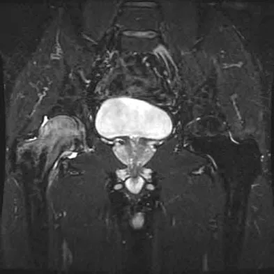 Hip & Knee Reconstruction 2007 Practice Questions: Set 3 (Solved) - Figure 12