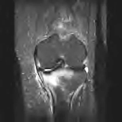 Hip & Knee Reconstruction 2007 Practice Questions: Set 3 (Solved) - Figure 18