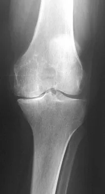 Hip & Knee Reconstruction Board Review 2007: High-Yield MCQs (Set 4) - Figure 10