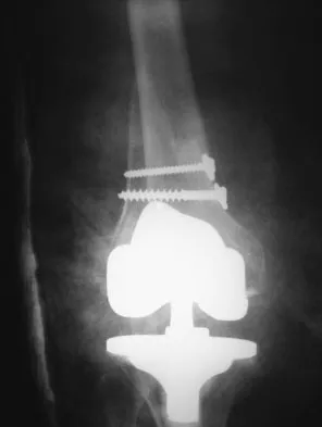 Orthopedic Board Review MCQs (2026 Edition) - Part 8