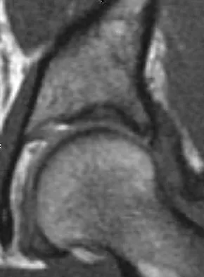 Hip & Knee Reconstruction Board Review 2007: High-Yield MCQs (Set 4) - Figure 3