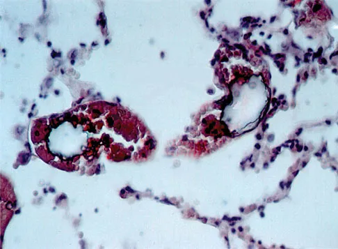 Hip & Knee Reconstruction Board Review 2007: High-Yield MCQs (Set 4) - Figure 6