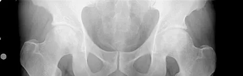 Hip & Knee Reconstruction Board Review 2007: High-Yield MCQs (Set 4) - Figure 9