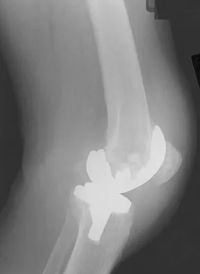 Hpkn 2026 MCQs: Board Review Questions & Answers (Part 1) - Figure 21