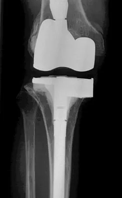Hpkn 2026 MCQs: Board Review Questions & Answers (Part 1) - Figure 37
