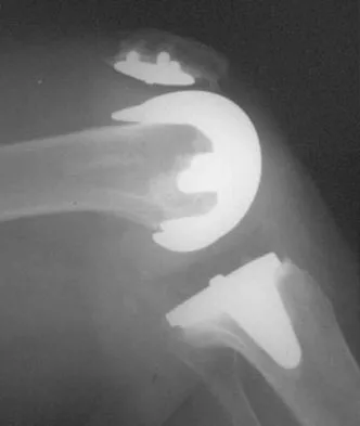 Hpkn 2026 MCQs: Board Review Questions & Answers (Part 1) - Figure 53