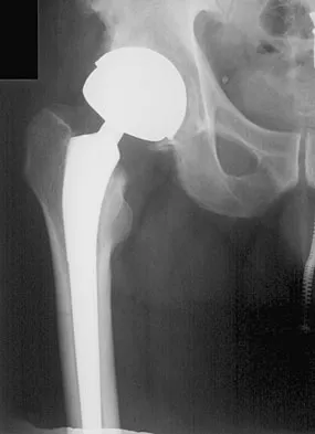 Hpkn 2026 MCQs: Board Review Questions & Answers (Part 2) - Figure 23