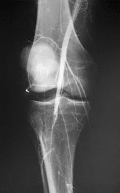 Hpkn 2026 MCQs: Board Review Questions & Answers (Part 2) - Figure 27