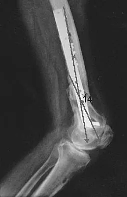 Hpkn 2026 MCQs: Board Review Questions & Answers (Part 2) - Figure 79