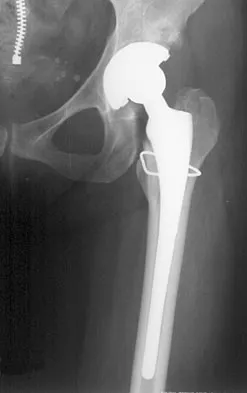 Hpkn 2026 MCQs: Board Review Questions & Answers (Part 2) - Figure 9