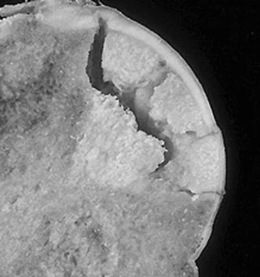 Hpkn 2026 MCQs: Board Review Questions & Answers (Part 3) - Figure 7