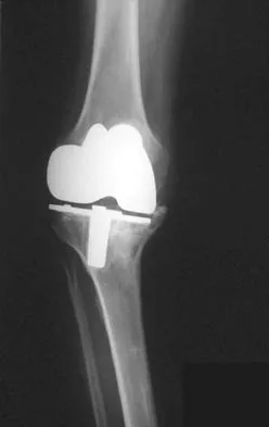 Hpkn 2026 MCQs: Board Review Questions & Answers (Part 4) - Figure 27