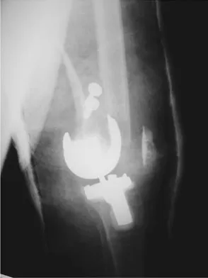 Hpkn 2026 MCQs: Board Review Questions & Answers (Part 4) - Figure 31