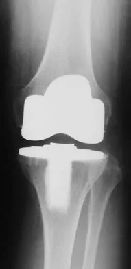 Hpkn 2026 MCQs: Board Review Questions & Answers (Part 4) - Figure 33