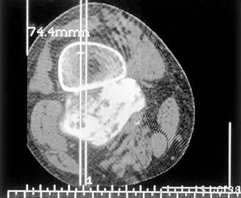 Mtd 2026 MCQs: Board Review Questions & Answers (Part 1) - Figure 103