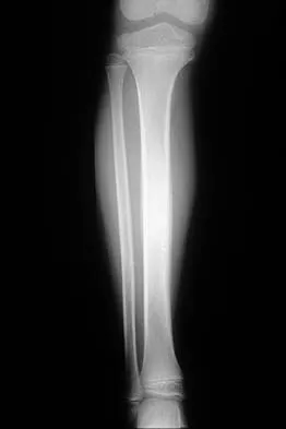 Mtd 2026 MCQs: Board Review Questions & Answers (Part 1) - Figure 113