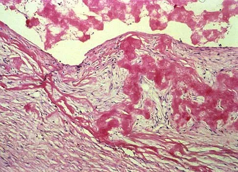 Mtd 2026 MCQs: Board Review Questions & Answers (Part 1) - Figure 141