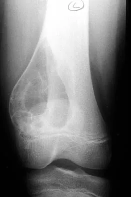 Mtd 2026 MCQs: Board Review Questions & Answers (Part 1) - Figure 143