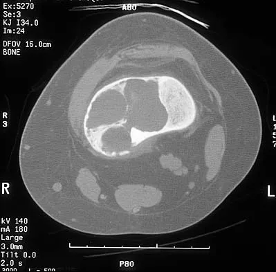 Mtd 2026 MCQs: Board Review Questions & Answers (Part 1) - Figure 145